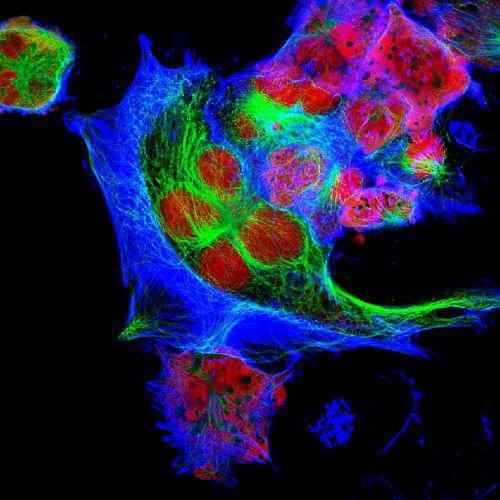 A fluorescence microscope image of neuroblastoma cells.